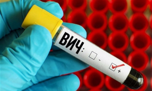 В Крыму уменьшилось количество заражений ВИЧ-инфекцией