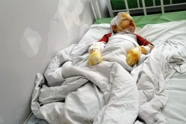 Взят под стражу житель Алушты, подпаливший машину со своим 4-летним сыном