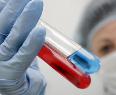 В Севастополе на 30% возросла заболеваемость ВИЧ