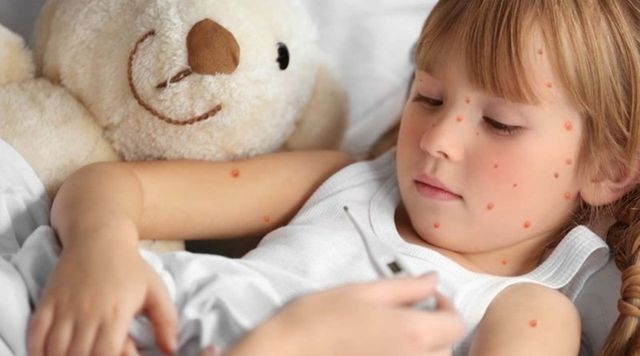 Родители маленьких детей в Севастополе в панике - в городе закончились вакцины от кори