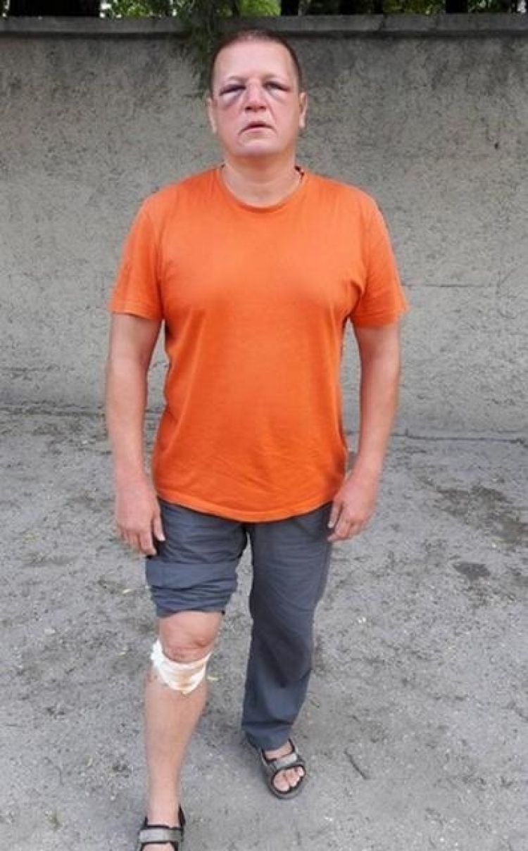 Силовики жестоко избили жителя Севастополя, утверждают, что за сопротивление