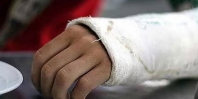 Еще один скандал в больнице - подростку с переломом руки не оказали помощь