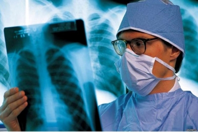 Борьбе с туберкулезом в оккупированном Севастополе мешают беженцы из оккупированного Донбасса