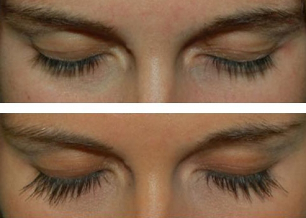 Карепрост – и ресницы завораживают длиною и объемом