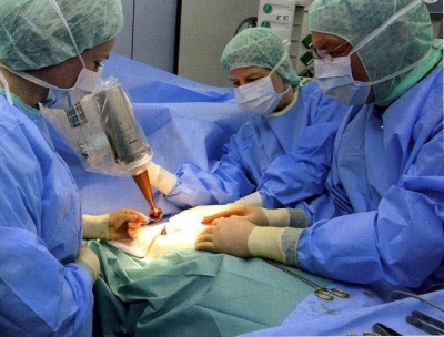 Чаще всего крымчане болеют раком кожи